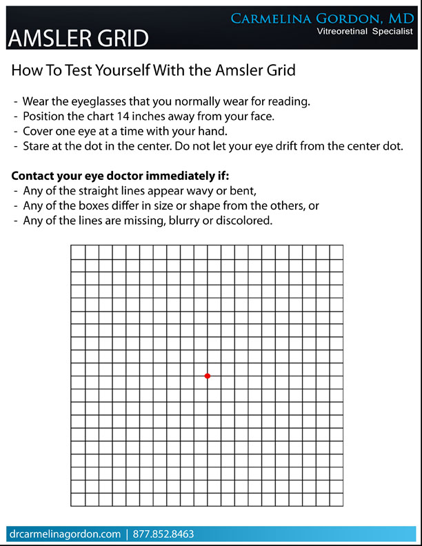 Amsler Grid Carmelina Gordon M D 