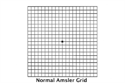 Normal Amsler Grid